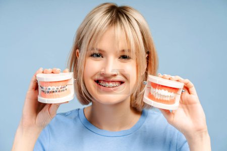 Téléchargez les photos : Portrait heureuse jeune femme mignonne avec des appareils dentaires sur les dents tenant modèle en plastique bocal humain avec des appareils dentaires isolés sur fond bleu. Dentisterie, soins de santé, concept de traitement orthodontique - en image libre de droit