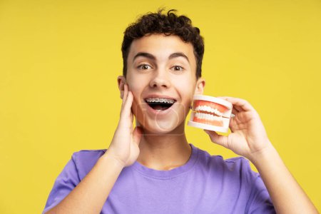 Photo for Excited, handsome boy, teenager with braces holding orthodontic jaw, looking at camera standing isolated on yellow background, closeup. Concept of dental, treatment - Royalty Free Image