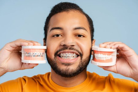 Closeup portrait photo of a smiling African American man with orthodontic braces, holding plastic jaw models with brackets, isolated on a blue studio background. Dental health concept