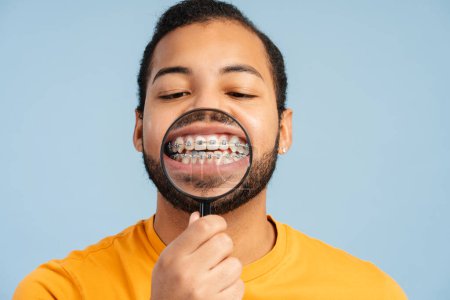 Foto de Foto de un atractivo hombre afroamericano con aparatos ortopédicos, mostrando sus dientes sanos a través de una lupa, aislado sobre un fondo azul. Concepto de cuidado dental - Imagen libre de derechos