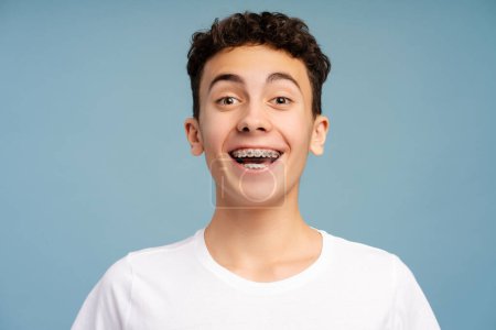 Photo for Young, excited, smiling boy, teenager with braces looking at camera with open mouth standing isolated on blue background. Concept of dental care, treatment - Royalty Free Image