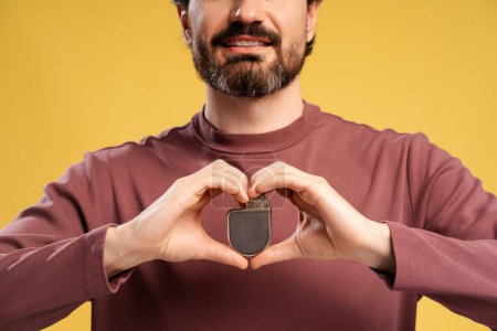 Close up of smiling bearded man showing cardiac pacemaker in two hands, isolated on yellow background. Health care, treatment concept