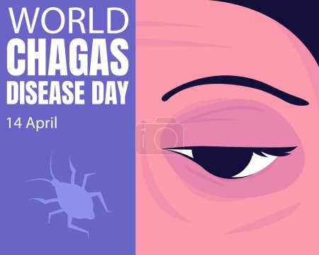 Ilustración de Illustration vector graphic of people's eyelids are swollen from kissing bug bites, showing insect silhouette, perfect for international day, world chagas disease day, celebrate, greeting card, etc. - Imagen libre de derechos