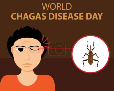 Illustration for Illustration vector graphic of A man's eyelid is swollen from an insect bite, perfect for international day, world chagas disease day, celebrate, greeting card, etc. - Royalty Free Image