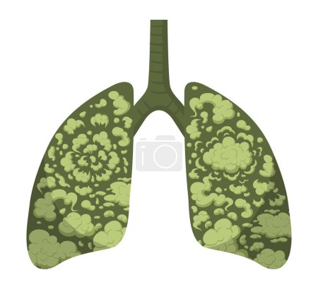 Ilustración de Pulmones contaminados. Dibujos animados sistema respiratorio poco saludable, contaminación del humo ambiental metáfora de los pulmones humanos ilustración vectorial plana. Pulmones humeantes - Imagen libre de derechos