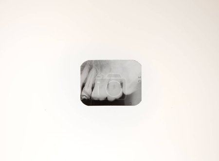 Gros plan radiographie des dents humaines sur un fond blanc vif. pour articles médicaux, revues, cliniques, tutoriels et plus