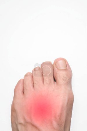 Un empeine de una persona pie izquierdo con una marca roja que representa el dolor, con espacio arriba para el texto