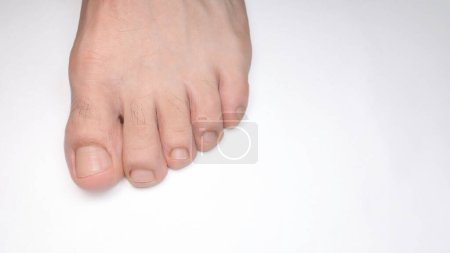 A Close of a person left foot toes with white background and space for text