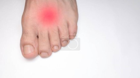 Eine Nahaufnahme des linken Fußes einer Person mit einem roten Fleck, der für Schmerz steht