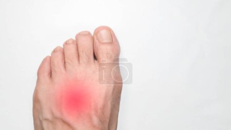 A Instep of a person left foot with a red mark representing pain, with space on the right for text