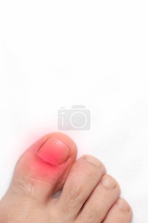 A Closeup of a toe with a red mark representing pain, with space above for text