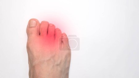 Les orteils du pied droit d'une personne avec une marque rouge représentant la douleur