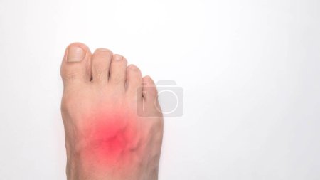 A Close up of the instep of a person right foot with a red mark representing pain
