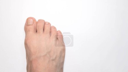 Eine Nahaufnahme einer Person Zehen des rechten Fußes mit weißem Hintergrund und Platz rechts für Text