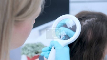 Photo for A trichologist examines the condition of the hair on the patient's head using a lens. - Royalty Free Image