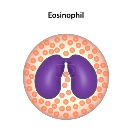 Foto de Un eosinófilo es un tipo de glóbulo blanco (leucocitos).) - Imagen libre de derechos