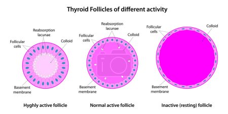 Illustration for Thyroid Follicles of different activity - Royalty Free Image