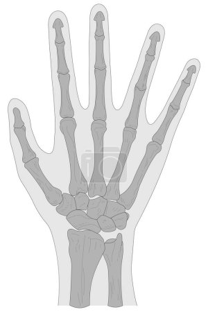 Illustration for Bones of the right hand, dorsal (posterior) view - Royalty Free Image