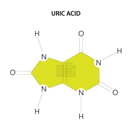 Ilustración de El ácido úrico es un producto de la descomposición metabólica de los nucleótidos de purina, y es un componente normal de la orina.. - Imagen libre de derechos