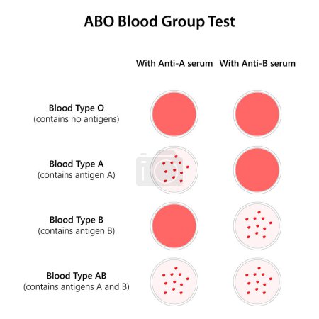 Illustration for ABO Blood Group Test. Illustration. - Royalty Free Image