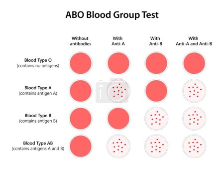 Téléchargez les illustrations : Test ABO Blood Group. Illustration. - en licence libre de droit