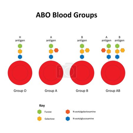 Téléchargez les illustrations : Groupes sanguins ABO et antigènes érythrocytaires - en licence libre de droit