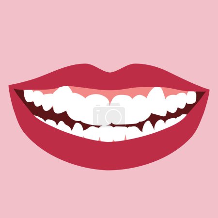 Illustration for Smile with orthodontic problem teeth crowding. Double tooth. Abnormal eruption. Opposite occlusion, open bite, crowded teeth, cavities, dentition. Vector illustration - Royalty Free Image