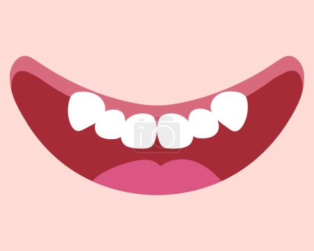 Illustration for Cartoon smiling mouth with teeth crowding. Double tooth. Abnormal eruption. Cute hand drawn smile. Vector illustration - Royalty Free Image