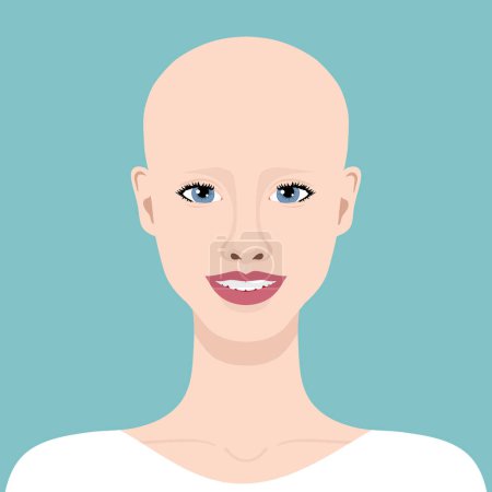 Téléchargez les illustrations : Jeune femme souriante avec alopécie. Belle chauve. Alopécie. Illustration vectorielle - en licence libre de droit