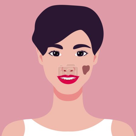 Beautiful smiling young woman with a birthmark on her face. Rare appearance. Portrait or an avatar. Vector illustration
