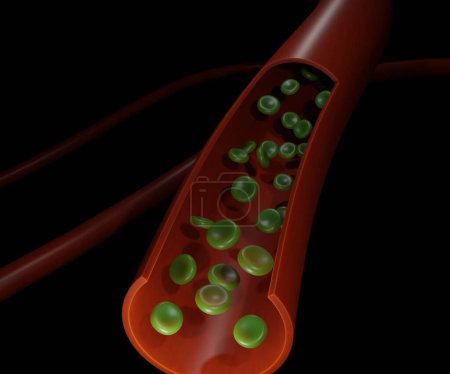 Photo for Sulfhemoglobinemia. The pigment is a greenish derivative of hemoglobin 3d rendering - Royalty Free Image