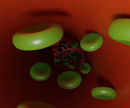 Photo for Sulfhemoglobinemia. The pigment is a greenish derivative of hemoglobin 3d rendering - Royalty Free Image