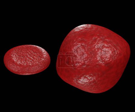Foto de Isolated swollen erythrocyte with normal red blood cell. Macrocytic anemia 3d rendering - Imagen libre de derechos