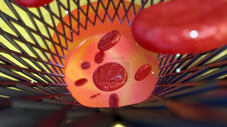 Téléchargez les photos : Aidé par l'échafaudage métallique d'une endoprothèse, minuscules globules rouges tissent leur chemin à travers le réseau labyrinthique d'un vaisseau sanguin, rendu 3d - en image libre de droit