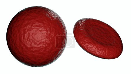 Téléchargez les photos : Rendu 3d de sphérocyte, c'est un globule rouge (RBC) qui est sphérique dans la forme, plutôt que la forme concave normale disque - en image libre de droit