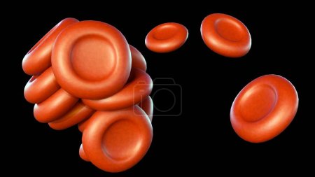 3d rendering of agglutination or hemagglutination, is an immune response when erythrocytes clump together.