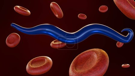 Foto de 3d renderización de los glóbulos rojos infectados por Plasmodium falciparum - Imagen libre de derechos