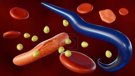 3D-Darstellung von Plasmodium falciparum: Der Merozoit dringt ein, entwickelt sich und vermehrt sich und reißt nach etwa 48 Stunden die roten Blutkörperchen