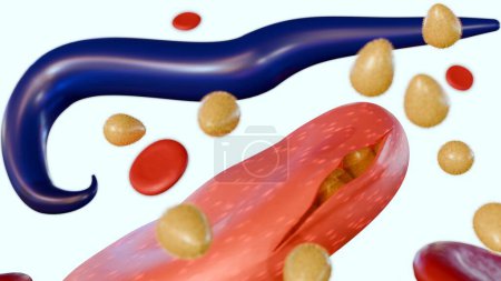 3D-Darstellung von Plasmodium falciparum: Der Merozoit dringt ein, entwickelt sich und vermehrt sich und reißt nach etwa 48 Stunden die roten Blutkörperchen