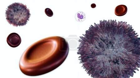 Téléchargez les photos : Le rendu 3d de la leucémie à cellules poilues (HCL) est un type rare de leucémie chronique qui se développe lentement à partir des globules blancs appelés lymphocytes B. - en image libre de droit
