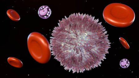 Die 3D-Darstellung der Hairy-Cell-Leukämie (HCL) ist eine seltene Form der chronischen Leukämie, die sich langsam aus weißen Blutkörperchen, den sogenannten B-Lymphozyten, entwickelt..