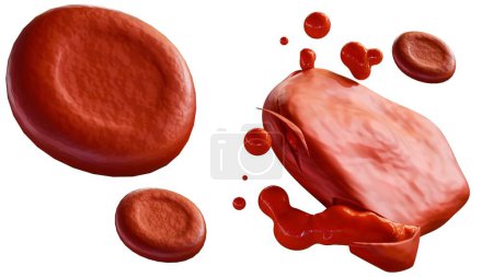 Téléchargez les photos : Rendu 3d de l'hémolyse, est le processus de globules rouges se décomposant et libérant leur contenu dans le fluide environnant - en image libre de droit