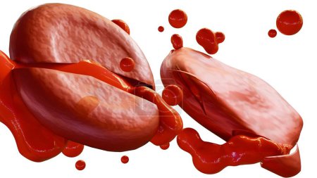 3D-Darstellung der Hämolyse, ist der Prozess der roten Blutkörperchen, die ihren Inhalt abbauen und in die umgebende Flüssigkeit abgeben