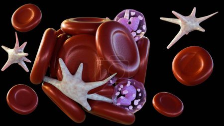 A 3D rendering of blood clot that travels to another part of the body is called an embolus