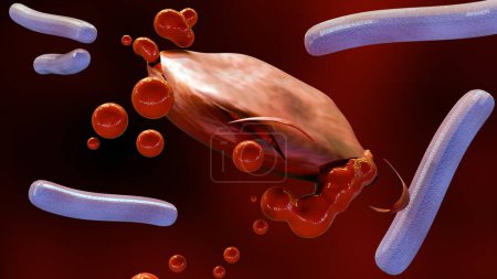 3D-Darstellung von Septikämie, oder Sepsis, ist der klinische Name für Blutvergiftung durch Klebsiella spp. Bakterien.