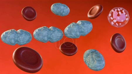 La septicémie, ou septicémie, est le nom clinique de l'intoxication sanguine par la bactérie Streptococcus pyogenes..