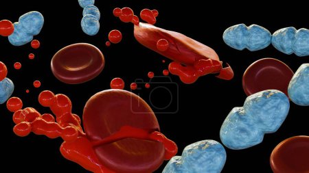 3D-Darstellung von Septikämie, oder Sepsis, ist der klinische Name für Blutvergiftung durch Streptococcus pyogenes Bakterien.