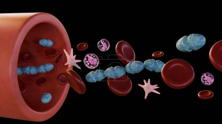 3D-Darstellung von Septikämie, oder Sepsis, ist der klinische Name für Blutvergiftung durch Streptococcus pyogenes Bakterien.