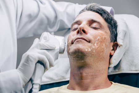 Téléchargez les photos : Médecin de la peau utilisant la technologie de traitement de soin du visage de refaçage HIFU avec un homme adulte pour réduire les rides et les cicatrices à la clinique anti-vieillissement - en image libre de droit