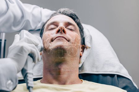 Téléchargez les photos : Médecin de la peau utilisant la technologie de traitement de soin du visage de refaçage HIFU avec un homme adulte pour réduire les rides et les cicatrices à la clinique anti-vieillissement - en image libre de droit